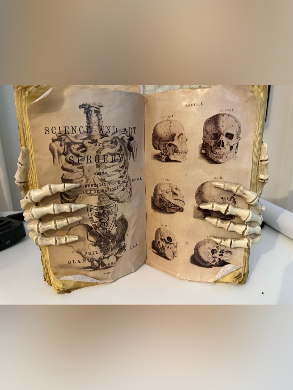 Skeleton Hands Antique Anatomy Book Decor Gothic Halloween Medical Curiosity